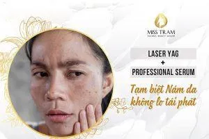 Sản phẩm dich vu dieu tri nam da an toan hcm 300x200 — Trung Tâm Thẩm Mỹ Miss Trâm — MST 0305993715