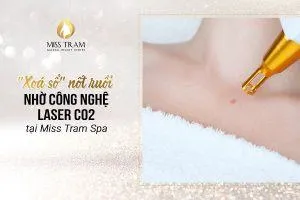 Sản phẩm dich vu xoa not ruoi khong de lai seo tphcm 300x200 — Trung Tâm Thẩm Mỹ Miss Trâm — MST 0305993715