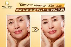 Sản phẩm gia dich vu nang co xoa nhan hcm 300x200 — Trung Tâm Thẩm Mỹ Miss Trâm — MST 0305993715