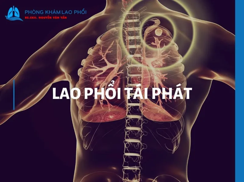 Sản phẩm 022604 lao phoi tai phat 1 — Phòng khám chuyên khoa lao và bệnh phổi — MST 0307655969