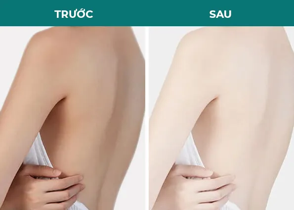 Sản phẩm before after tam trang — Thẩm Mỹ Diamond — MST 0309944010