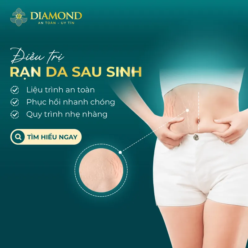 Sản phẩm DV Dieu tri ran da — Thẩm Mỹ Diamond — MST 0309944010