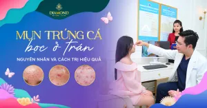 Sản phẩm THUMB Mun trung ca boc o tran 300x157 — Thẩm Mỹ Diamond — MST 0309944010