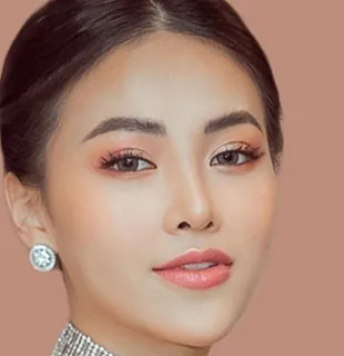 Sản phẩm Phau thuat tham my thon gon khuon mat — Công Ty TNHH Bệnh Viện Thẩm Mỹ Việt Mỹ — MST 0310494380
