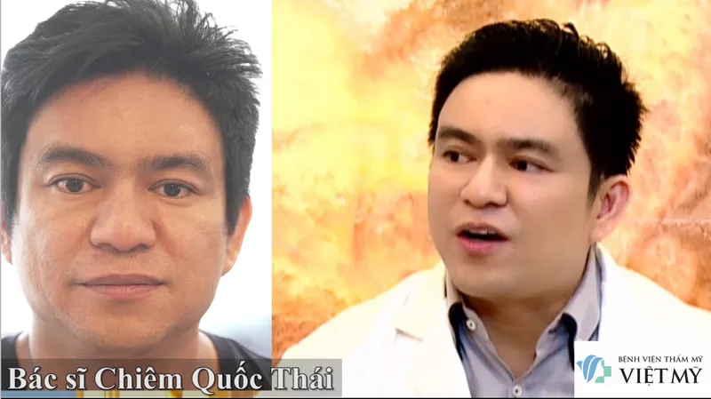Sản phẩm bac si chiem quoc thai truoc va sau cang da mat — Công Ty TNHH Bệnh Viện Thẩm Mỹ Việt Mỹ — MST 0310494380