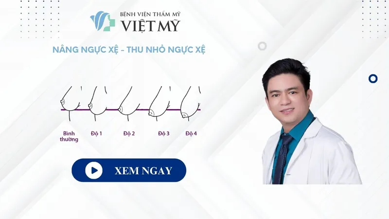 Sản phẩm Nang Nguc Xe Thu nho nguc xe Bac si Thai Benh vien tham my Viet My — Công Ty TNHH Bệnh Viện Thẩm Mỹ Việt Mỹ — MST 0310494380