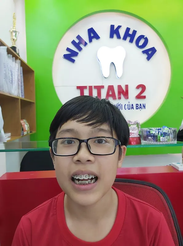 Sản phẩm 1304696885538680 — Nha Khoa TITAN — MST 0312328678