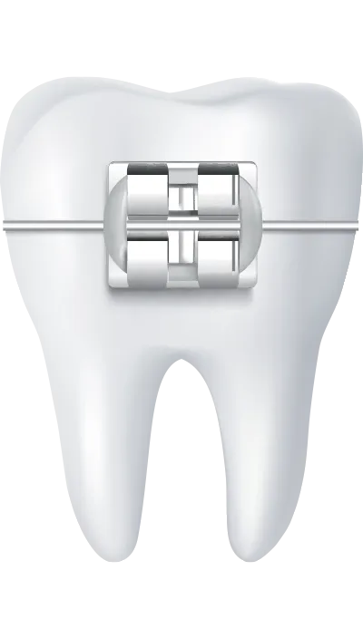 Sản phẩm ly do chon updental — Công Ty CP Up Dental — MST 0313476125