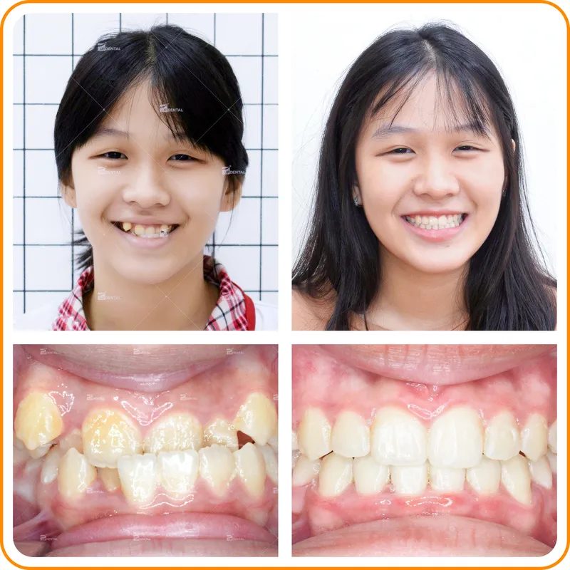 Sản phẩm mom — Công Ty CP Up Dental — MST 0313476125