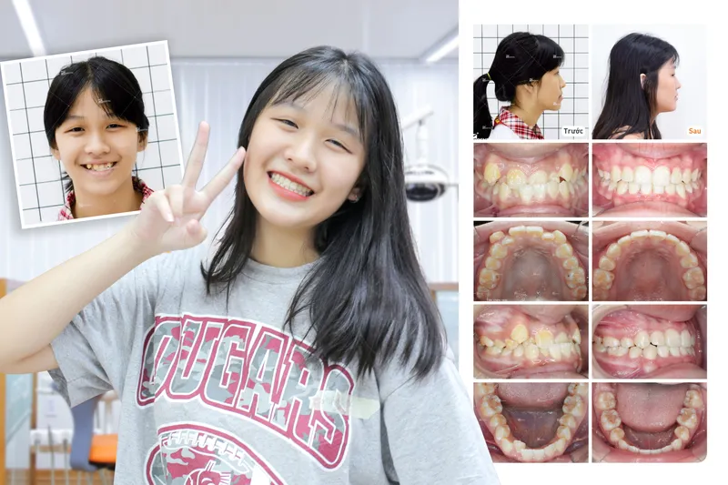 Sản phẩm mylinh — Công Ty CP Up Dental — MST 0313476125