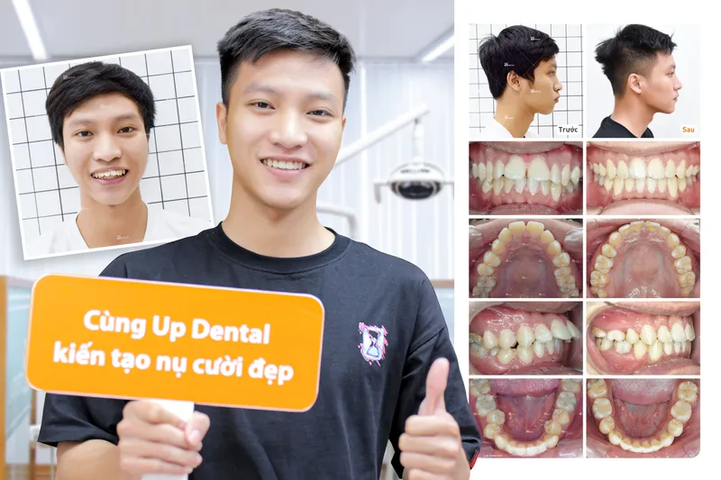 Sản phẩm thetruyen — Công Ty CP Up Dental — MST 0313476125
