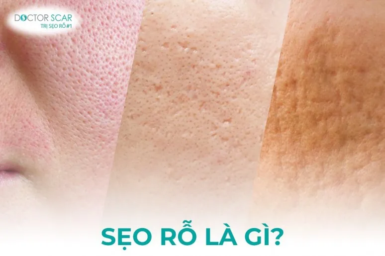 Sản phẩm 7557c60a4cc0c8c75a878167f57923e1 — Công Ty TNHH Doctor Scar — MST 0313505873