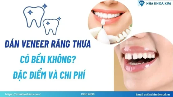 Sản phẩm dan veneer rang thua 6 555x312 — Công Ty TNHH Nha Khoa Kim — MST 0313956153