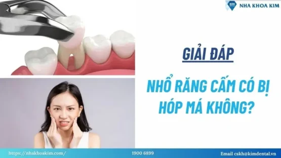 Sản phẩm nho rang cam co bi hop ma khong 2 555x312 — Công Ty TNHH Nha Khoa Kim — MST 0313956153