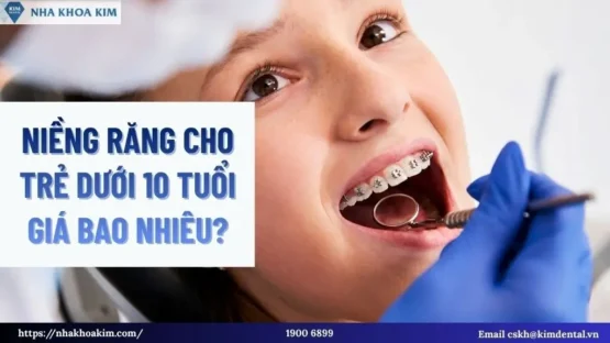 Sản phẩm nieng rang cho tre duoi 10 tuoi 2 555x312 — Công Ty TNHH Nha Khoa Kim — MST 0313956153