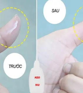 Sản phẩm huong dan cach go keo 502 nhanh chong hieu qua 1 9196 — Công Ty TNHH Công Nghệ Laser Thiên Phú — MST 0314300195