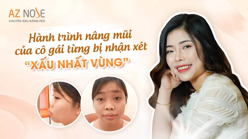 Sản phẩm thu heo sau khi sua mui hong 1 — Công Ty TNHH Thẩm Mỹ AZ NOSE — MST 0314581041
