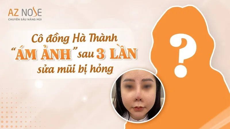 Sản phẩm co dong ha thanh noi am anh sau 3 lan sua mui hong 1 — Công Ty TNHH Thẩm Mỹ AZ NOSE — MST 0314581041