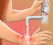 Sản phẩm bien phap so cuu khi bi bong 1 39c7yo4suh3u8su3u3ku16 — Công Ty TNHH Ashio — MST 0315107613
