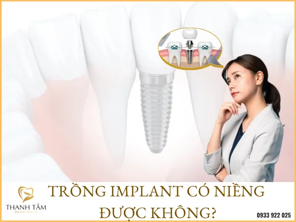 Sản phẩm trong implant co nieng duoc khong — Công Ty TNHH MTV Khánh An - Nha Khoa Thanh Tâm — MST 0315420625