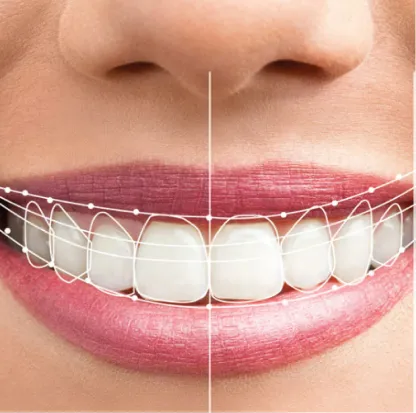 Sản phẩm nhan loi duong cuoi — Công ty TNHH Nha Khoa My Auris — MST 0315494874
