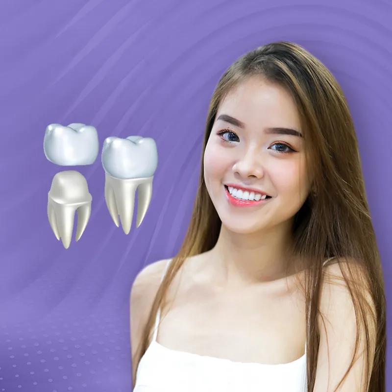 Sản phẩm img boc rang su 01 — Công ty TNHH Nha Khoa My Auris — MST 0315494874