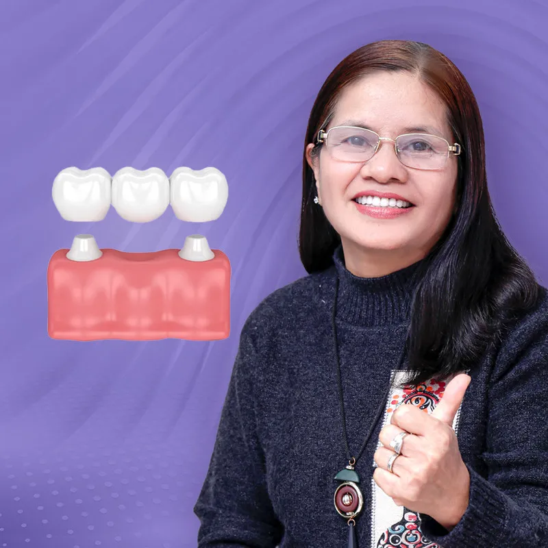 Sản phẩm img cau rang su — Công ty TNHH Nha Khoa My Auris — MST 0315494874