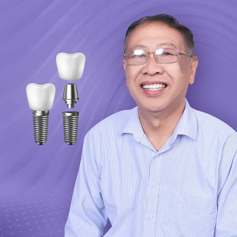 Sản phẩm img trongrang implant — Công ty TNHH Nha Khoa My Auris — MST 0315494874