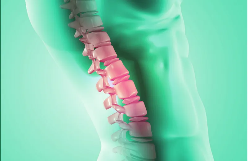 Sản phẩm Gai cot song — Phòng Khám Xương Khớp USA Pain Center — MST 0315709463