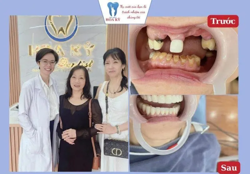 Sản phẩm 150 nha khoa uy tin xa Kim Long TPHCM 1 — Công Ty TNHH Nha Khoa Hoa Kỳ — MST 0316462836
