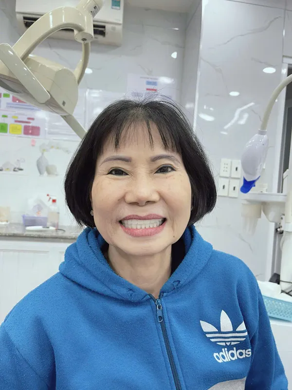 Sản phẩm khach hang nha khoa hoa ky 7 — Công Ty TNHH Nha Khoa Hoa Kỳ — MST 0316462836