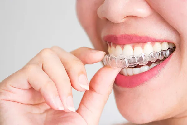 Sản phẩm nieng rang — Công Ty Cổ Phần TM DV Nha Khoa Ador — MST 0316577876
