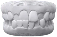 Sản phẩm tooth3 — Công Ty Cổ Phần Tập Đoàn Thẩm Mỹ Otis — MST 0316590108