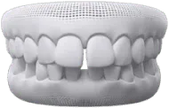 Sản phẩm tooth4 — Công Ty Cổ Phần Tập Đoàn Thẩm Mỹ Otis — MST 0316590108