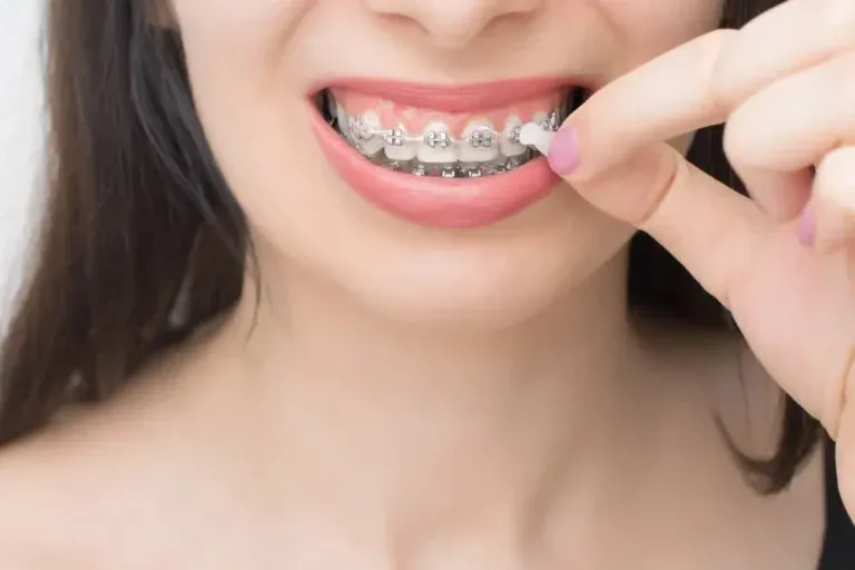 Sản phẩm cach dung sap nha khoa 768x512 — Công Ty Cổ Phần Tập Đoàn Thẩm Mỹ Otis — MST 0316590108