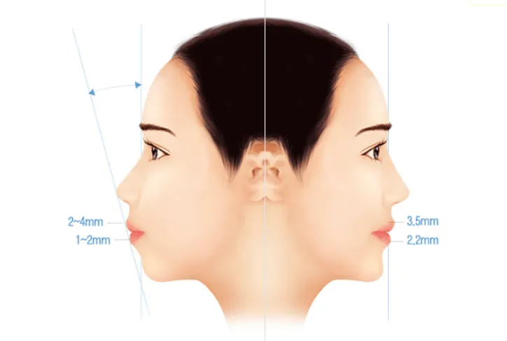 Sản phẩm cam lem — Công Ty Cổ Phần Tập Đoàn Thẩm Mỹ Otis — MST 0316590108
