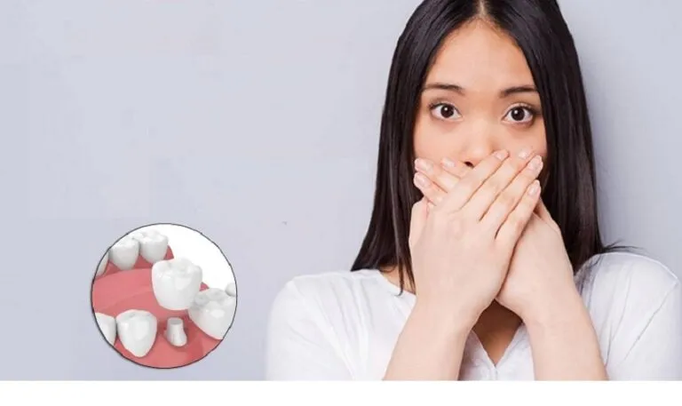 Sản phẩm trong rang implant co bi hoi mieng khong 768x457 — Công Ty Cổ Phần Tập Đoàn Thẩm Mỹ Otis — MST 0316590108