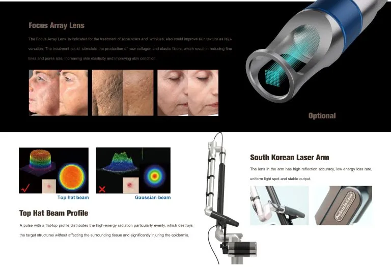 Sản phẩm PS500 brochure of Picosecond laser 4 modes hinh anh 3 768x525 — Công Ty TNHH Thương Mại Dịch Vụ Kỹ Thuật HTMED — MST 0317166597