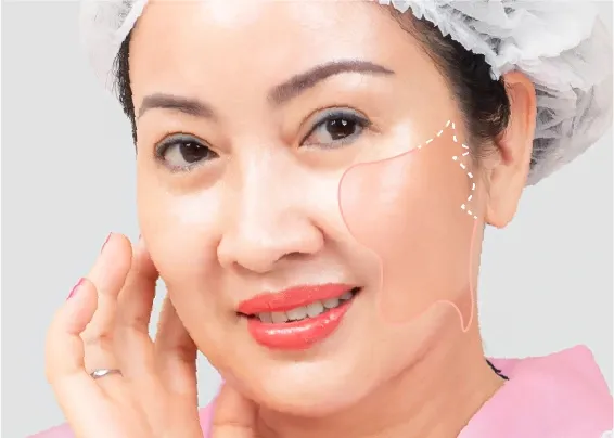 Sản phẩm dich vu cang da mat — Công Ty TNHH Thẩm Mỹ Linh Anh Saigon — MST 0317532839