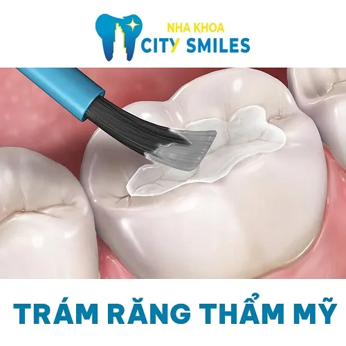 Sản phẩm 2 1 — Công Ty Cổ Phần City Smiles — MST 0317541463