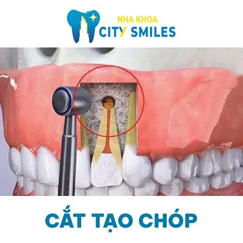 Sản phẩm Cat nao chop — Công Ty Cổ Phần City Smiles — MST 0317541463