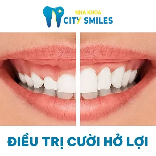 Sản phẩm Cuoi Ho Loi — Công Ty Cổ Phần City Smiles — MST 0317541463