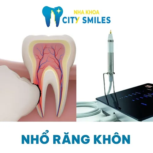 Sản phẩm Nho Rang Khon — Công Ty Cổ Phần City Smiles — MST 0317541463