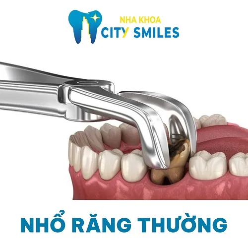 Sản phẩm Nho rang thuong — Công Ty Cổ Phần City Smiles — MST 0317541463