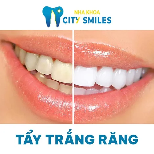 Sản phẩm Tay trang rang — Công Ty Cổ Phần City Smiles — MST 0317541463