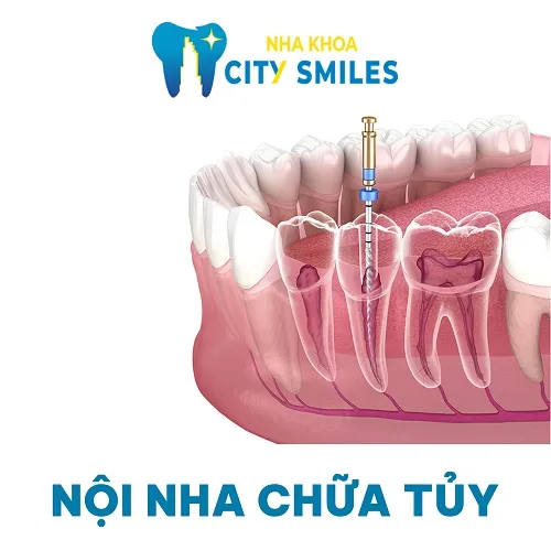 Sản phẩm noi nha chua tuy — Công Ty Cổ Phần City Smiles — MST 0317541463