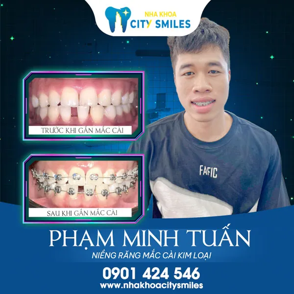 Sản phẩm 22 — Công Ty Cổ Phần City Smiles — MST 0317541463