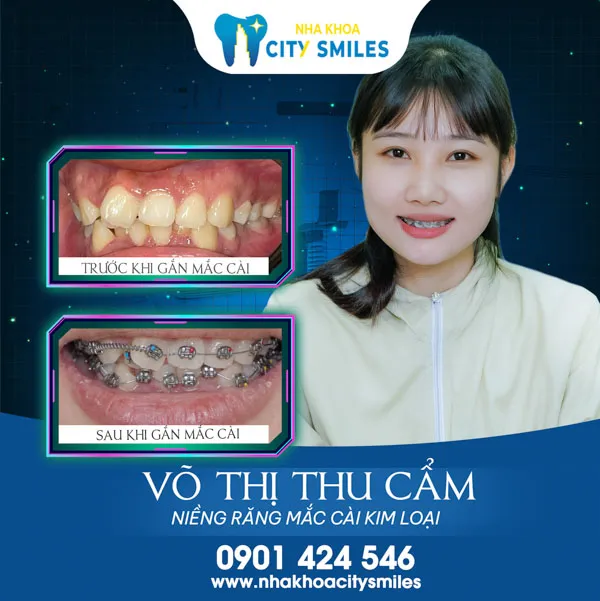 Sản phẩm city a choi — Công Ty Cổ Phần City Smiles — MST 0317541463