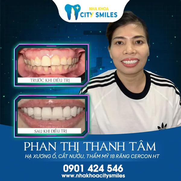 Sản phẩm city nua a — Công Ty Cổ Phần City Smiles — MST 0317541463
