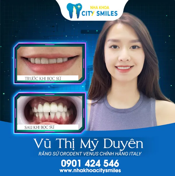 Sản phẩm ct — Công Ty Cổ Phần City Smiles — MST 0317541463